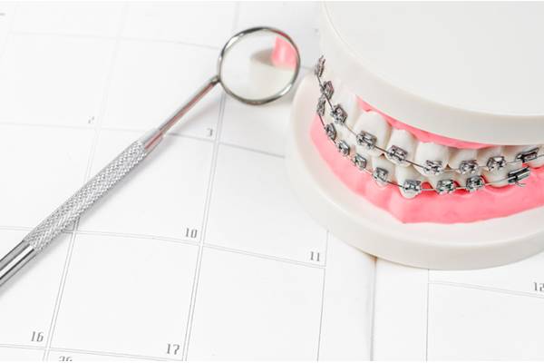 Dental model with braces and mirror tool placed on calendar at SS Orthodontics in Glendale and Phoenix, AZ